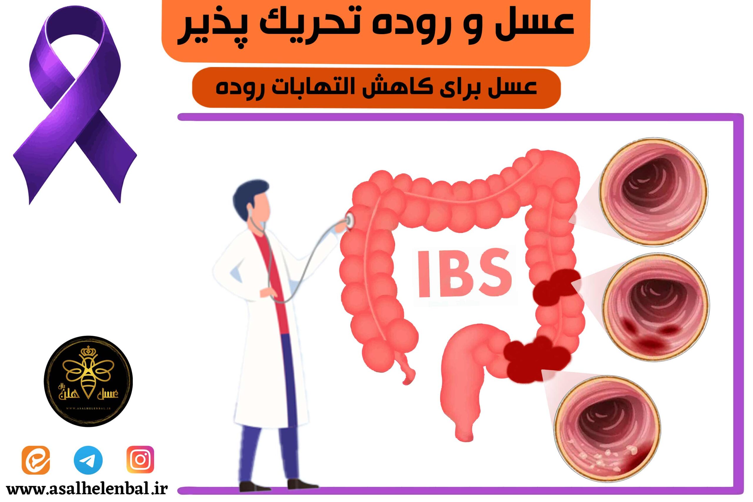 عسل برای روده تحریک پذیر